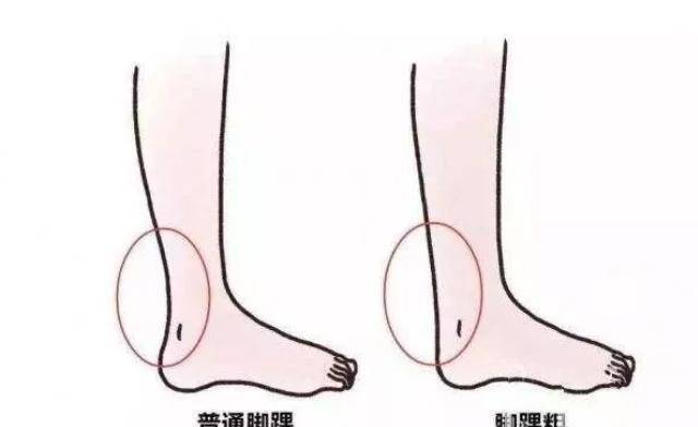 杨幂的脚踝纤细到让人羡慕,热巴瘦成纸片人,脚踝更是细得惊人!