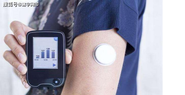 图源网络植入式血糖仪,其真正植入皮下组织的是作为探头的电极部分