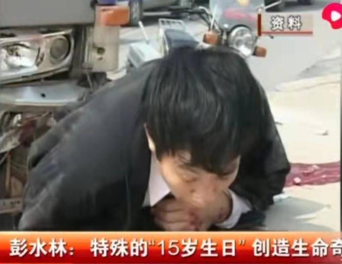 彭水林被货车"削"成78厘米,妻子不离不弃,如今当上老板_医生_手术