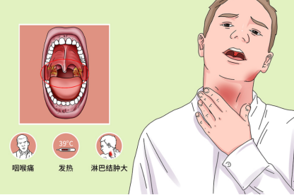 喉咙疼痛,发热,吞咽困难!
