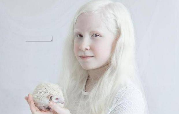 幸好不是所有的坦桑尼亚人都是落后的蛮夷,国家的相关部门为了保护