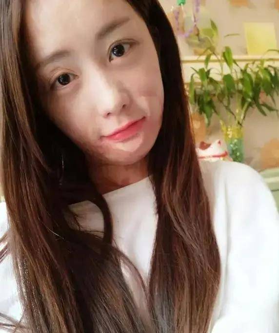 原创16岁少女周岩因拒官二代追求被其毁容现在还好吗