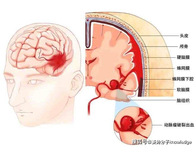 头颅硬膜图片