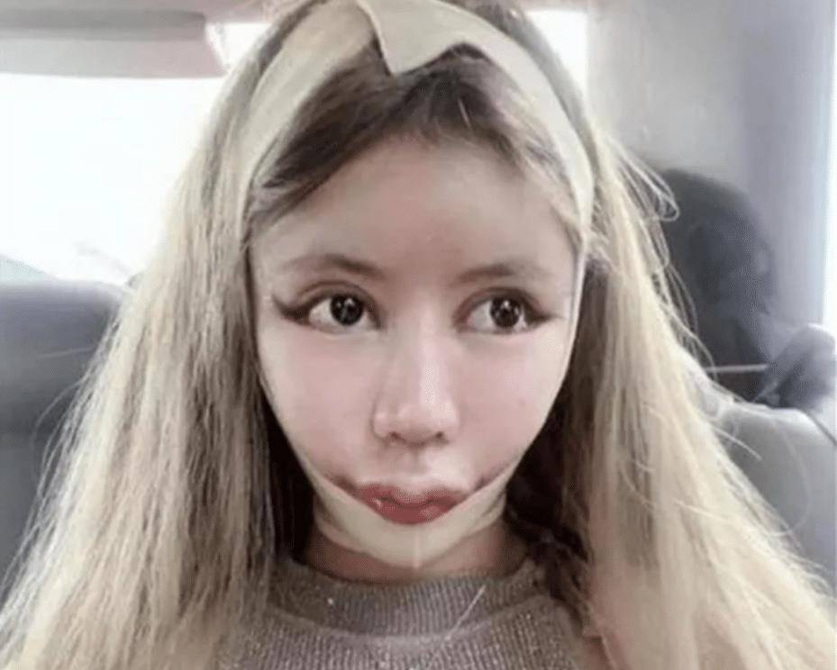 "花费近百万",三年整了60次的网红女孩现今如何:判若两人