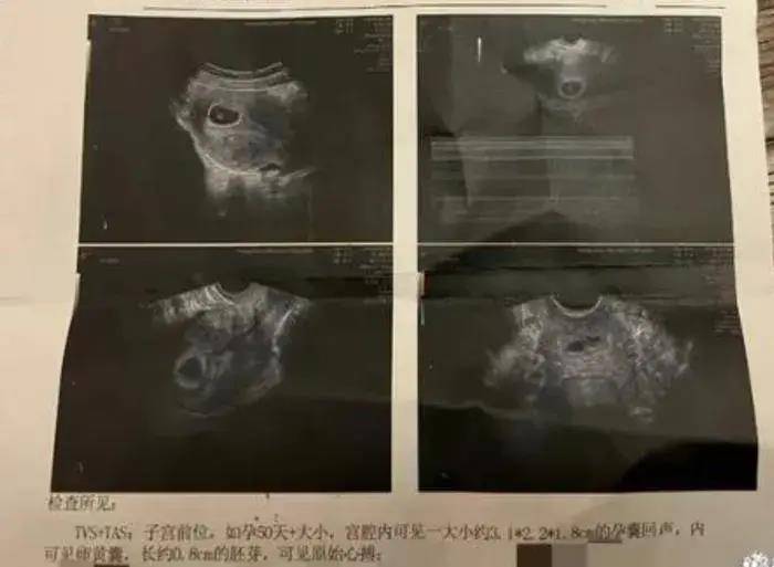 72岁张纪中与42岁妻杜星霖宣布怀上第三胎,晒验孕棒和b超单_夫妇_婚姻