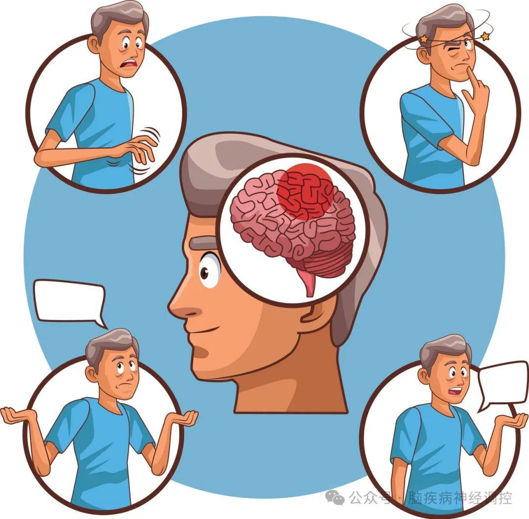 早发性和迟发性癫痫是脑外伤和脑卒中患者中的一种特殊病例.