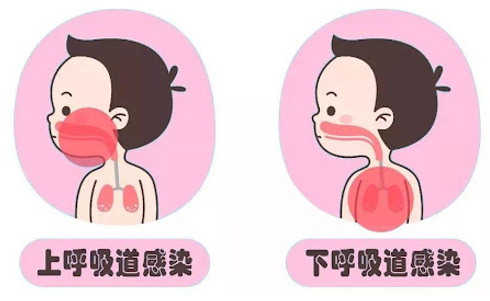 宝爸宝妈必看春季呼吸道传染病预防