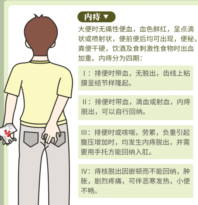 判断自己有没有痔疮看这里