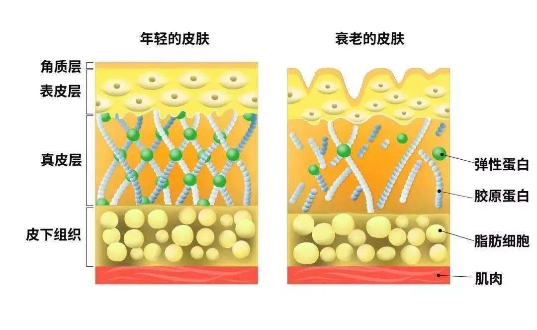 皮肤衰老过程示意图图片