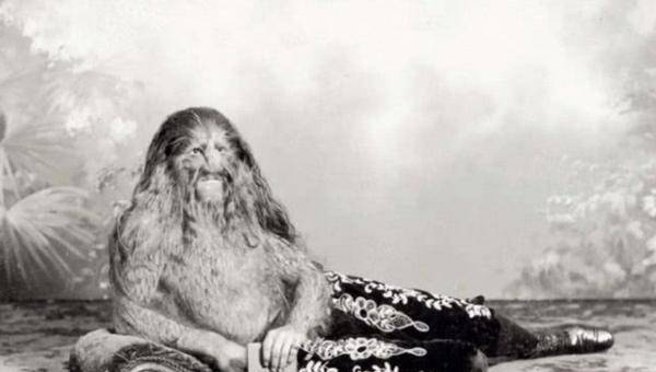 真正的半狮人因怪异外形红遍欧洲精通5国语言却不幸早逝