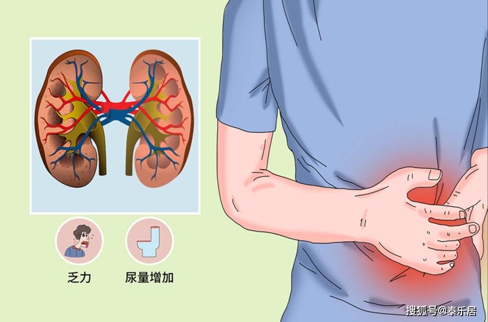 肾脏保卫战 世界肾脏病日