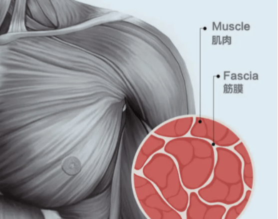对于长时间久坐,缺乏运动的人群来说,筋膜枪能够有效预防肌肉纤维化和