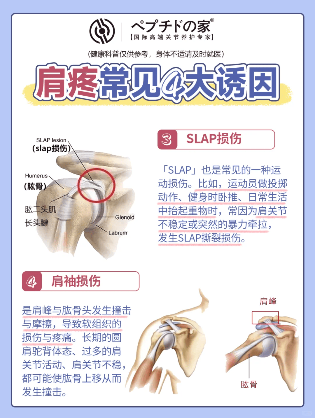 肩膀疼痛是许多人常常遇到的问题,它可能源自多种原因,包括姿势不良