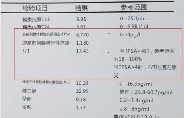 抽血化验报告单图片图片