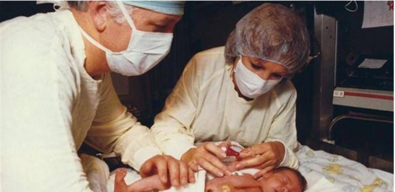 为救初生女儿,冒险为其移植狒狒心脏,最后怎样了_特蕾莎_孩子_医生