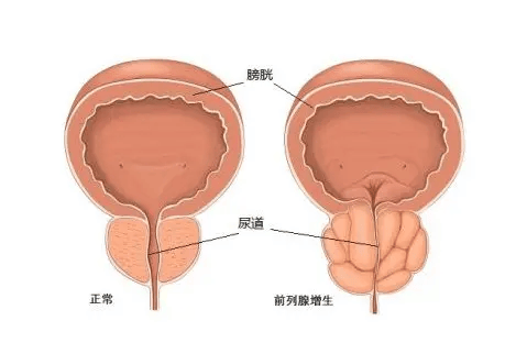 前列腺和睾丸的构造图图片