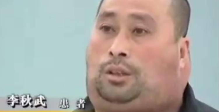 二人去了很多医院,得到的结果全是"治不了".