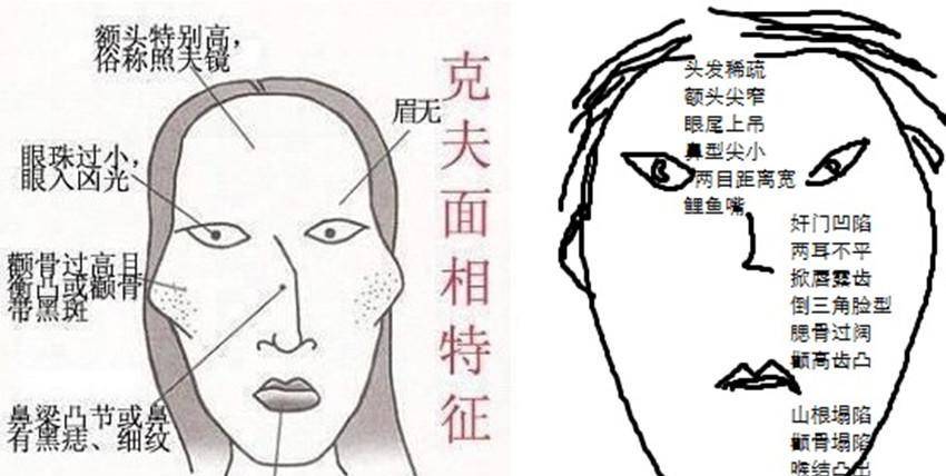 嫁一个死一个,再嫁一个又死了,有一个还未出嫁,老公就提前死了_克夫