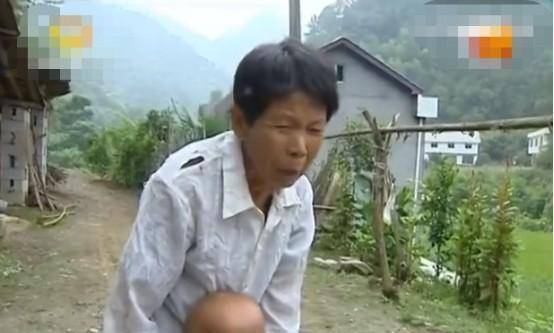 2014年,湖南6岁"石头娃"皮肤如石头堆砌,姐姐辍学挣钱救弟_覃奥_覃业