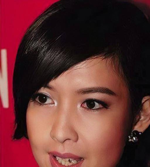 原创亮瞎眼明星烤瓷牙变灾难嘴包不住牙嘴凸变老演戏难看