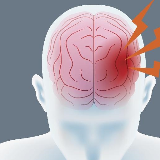 原创脑中风是四高疾病预防脑中风做好6件事