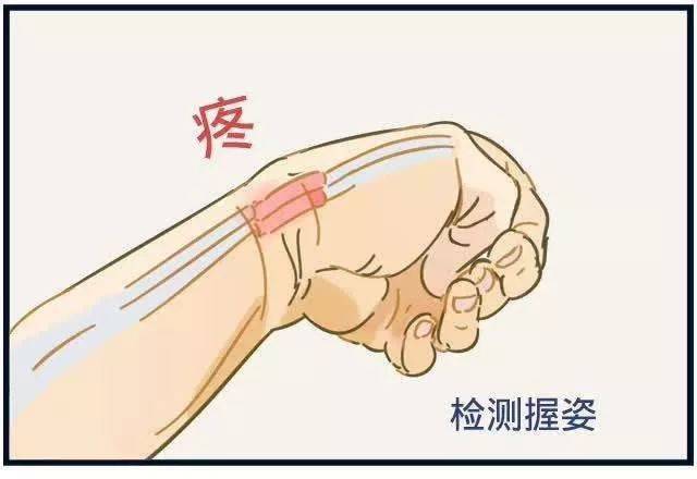 大拇指腱鞘炎怎么锻炼这样真行吗