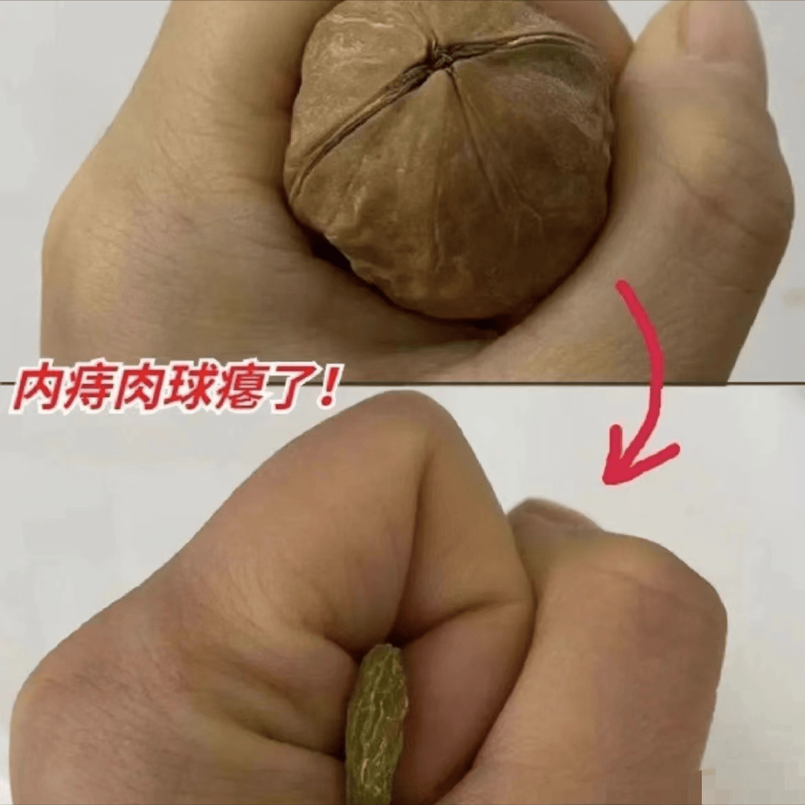 每个人对应的症状肯定是有所不同的,如果只是轻微的便血或瘙痒,可以