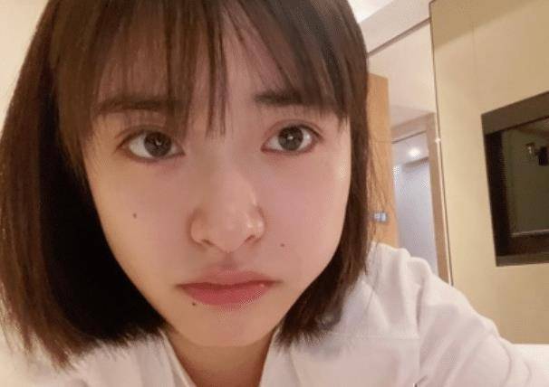 原创沈月拔智齿第二天直接脸肿晒敷冰块照片太真实了