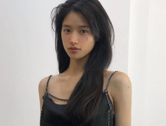 原创段小薇拔智齿脸颊肿大像发面馒头本尊晒吐血照引热议