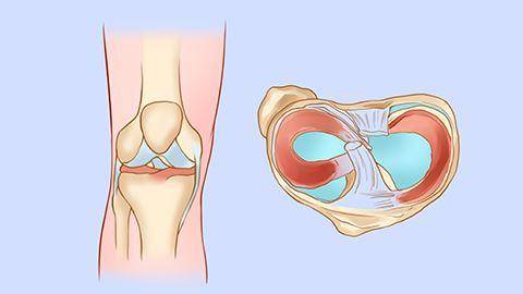 滑膜炎的土方法怎么治这样的真行