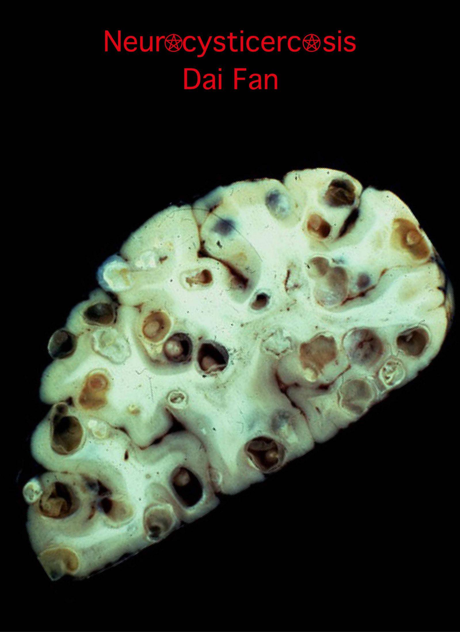 2017《异形寄生》· 在猪脑内培育脑囊虫.