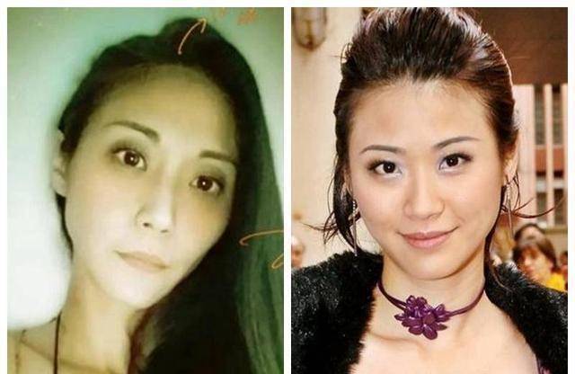 原创原创47岁刘绰琪近况双颊凹陷状态引人担忧曾自爆患人格障碍症