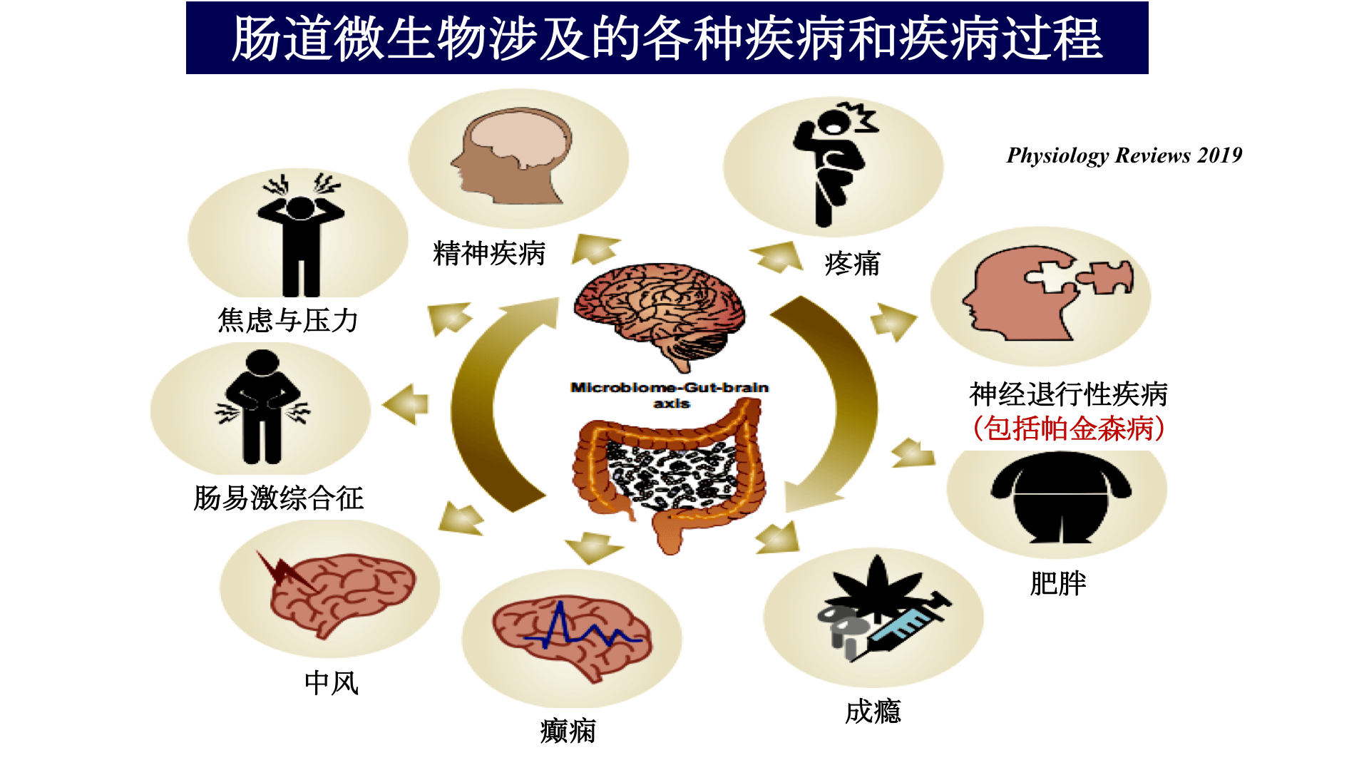 【cc讲坛】朱进霞:肠胃功能紊乱,帕金森病的早期预警信号_病人_疾病