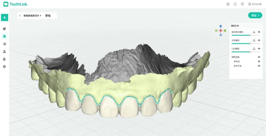 TeethLink齿领国产AI智能三维面部扫描系统_患者_牙齿_数据