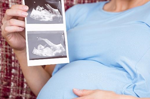 原创产后宝妈这4处会有明显变化尤其第4处准妈妈要做好心理准备