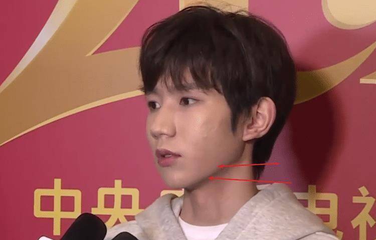 原创王源再次接受电视采访在照妖镜之下面部上痘痘很明显