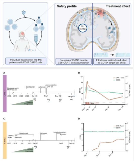 cart细胞治疗又一种自身免疫病多发性硬化症