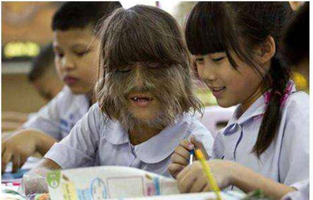 因返祖她全身毛发旺盛,无人愿意亲近,体毛褪下后,网友:好惊艳