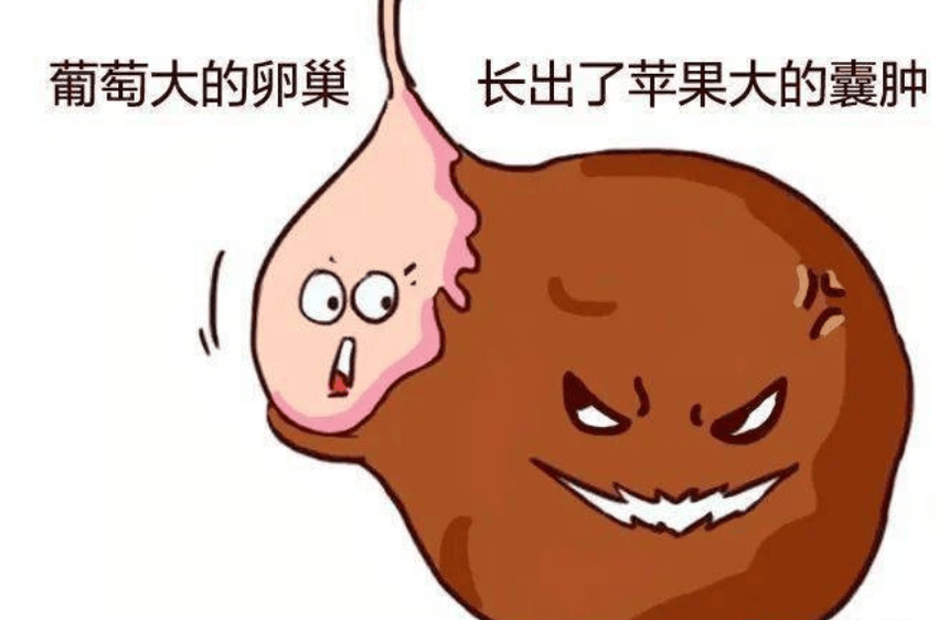 巧克力囊肿可以怀孕吗图片