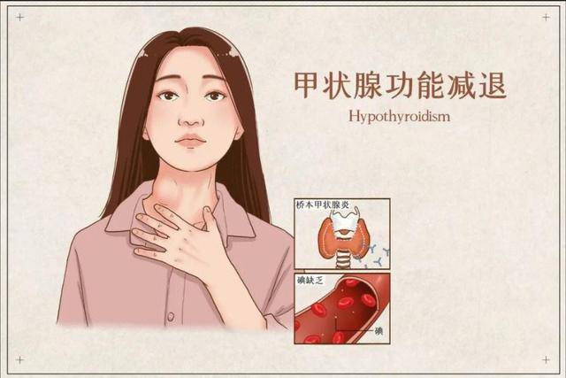 原创甲减患者需要长期服用甲状腺素片担心有副作用那该怎么办