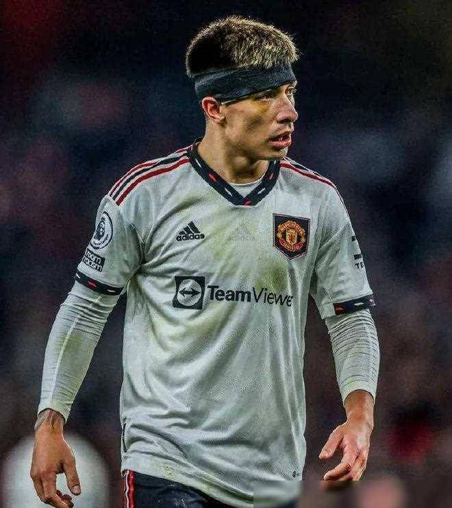 曼联铁卫本赛季第3次受伤 踢球风格和兽医是两大主因_哈里·麦奎尔