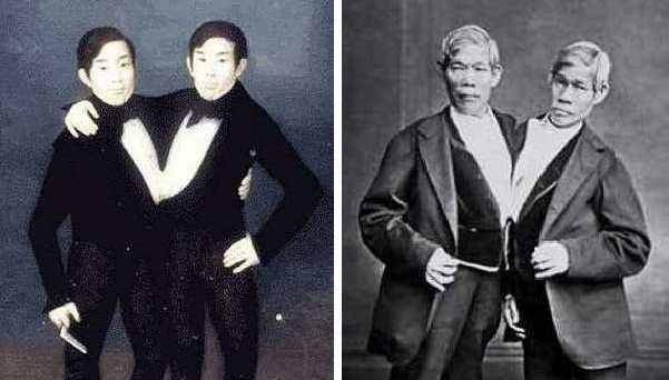 泰国连体兄弟娶了一对姐妹,生育了22个孩子_邦克_罗伯特_皇宫