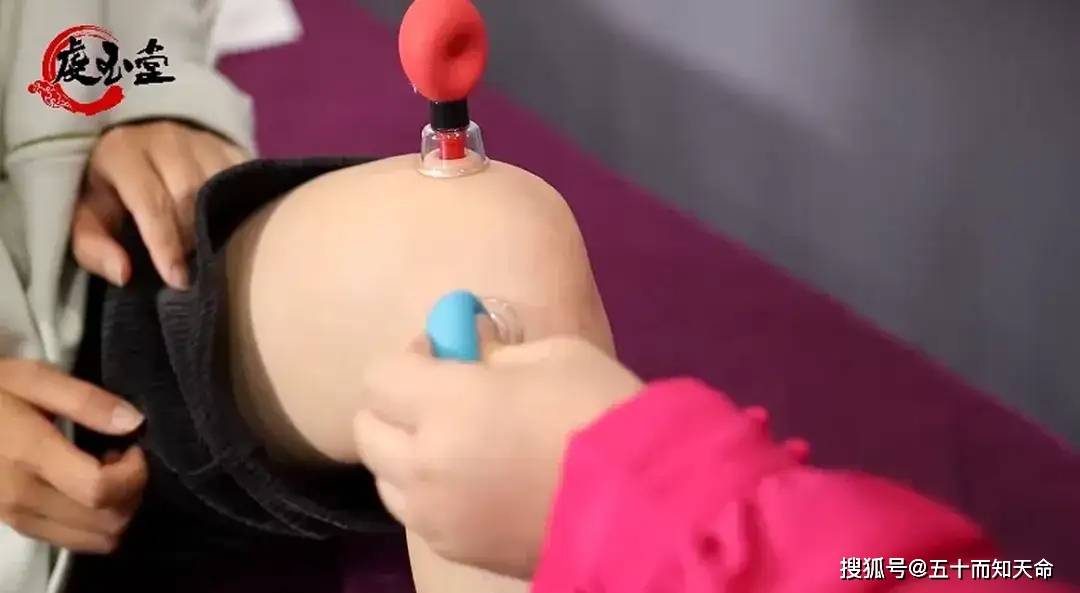 针灸作为中医重要技艺,已传承至少5000年,遍布全球160多个国家和地区