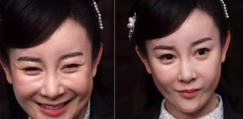 原创娄艺潇成蔡明陈小纭变大美人整容这条捷径到底好不好走
