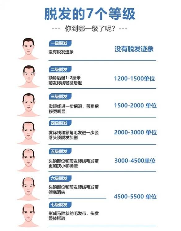 脱发用什么洗发水好可以防止脱发好物种草错过亏大发了