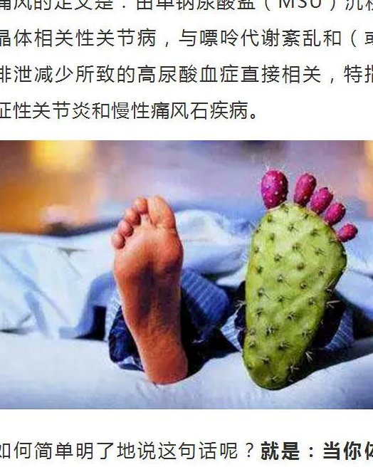 原创夏季是痛风发作的高发季记住这点降低尿酸远离痛风