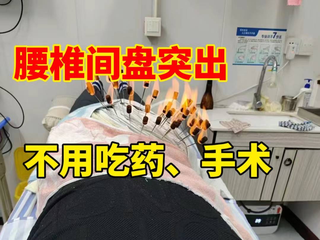 腰突疼痛反反复复不见好记住这四个养护秘诀21天摆脱腰疼腿麻