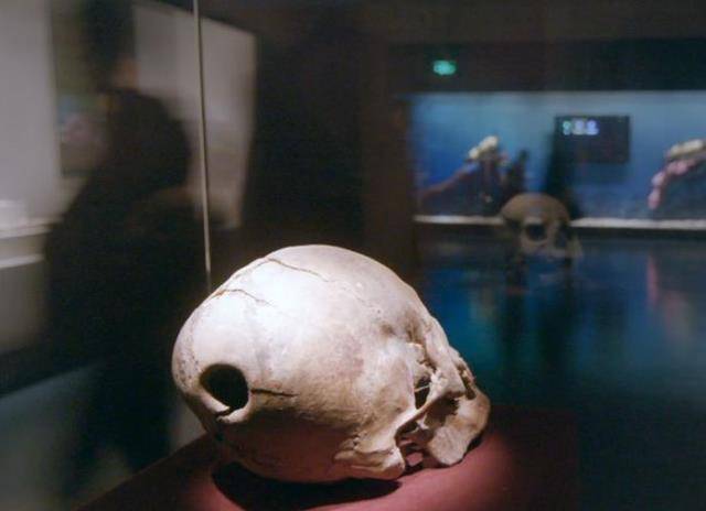 原创华佗给曹操开颅有手术条件吗认真了解一下1800年前的中医