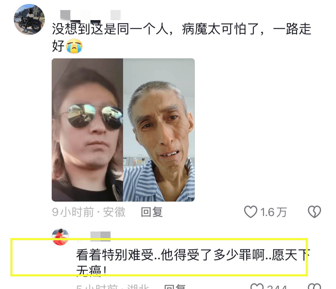 原创笑坏了47岁网红毛毛去世三年化疗瘦到脱相模样似80岁惹人感慨