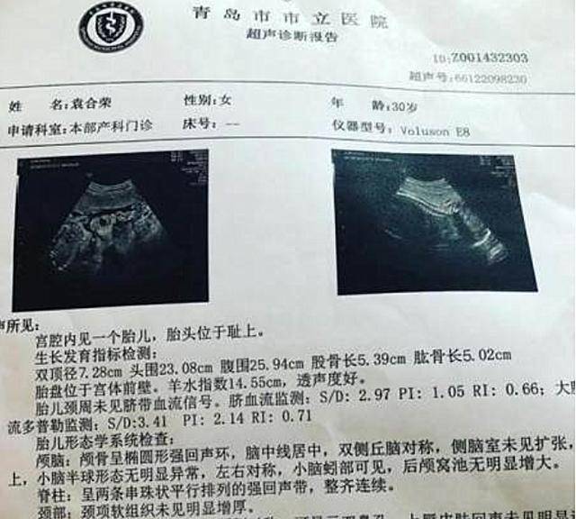 怀孕6个月金刚芭比健身房撸铁